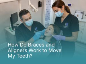 How Do Braces and Aligners Work to Move My Teeth?